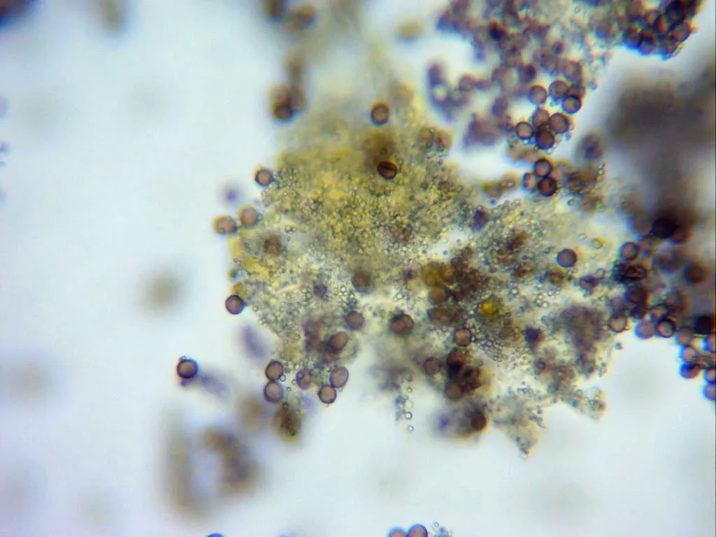 Microscopía de Physarum virescens - 12 - Placas cristal peridio agua 2